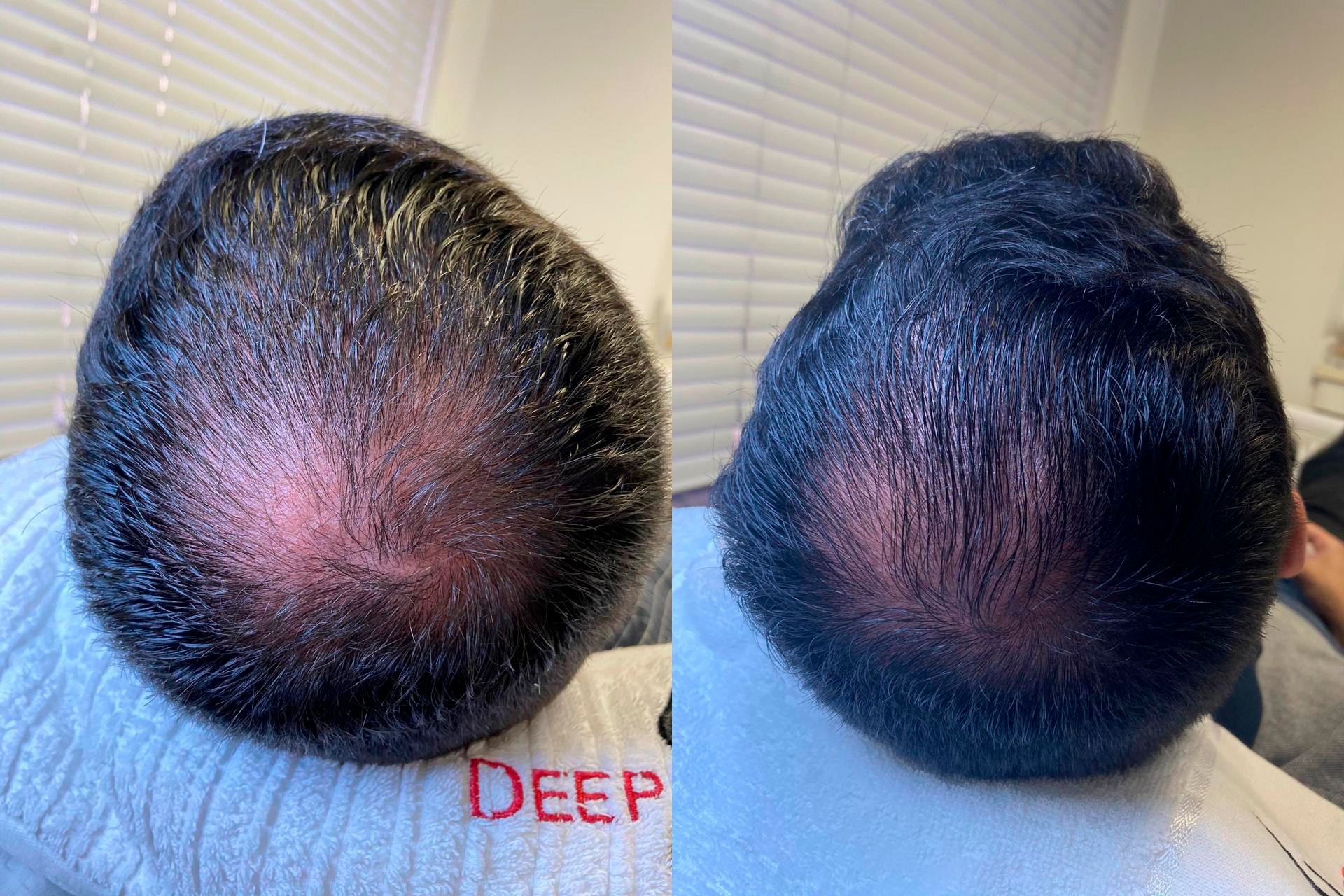 Tratamento Capilar Antes e Depois